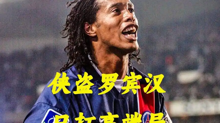 球的代表之